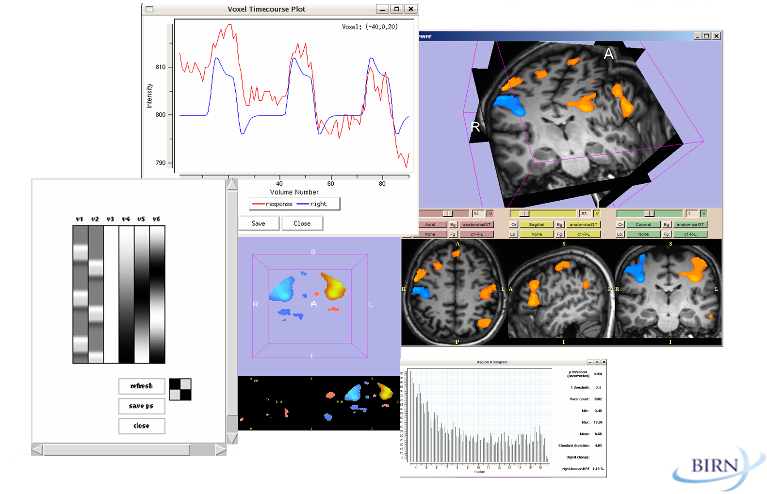 fMRI Examples