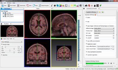 NiftyView (based on MITK Workbench)