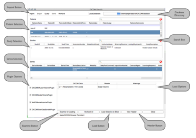 DICOM Table Interface integrated in 3D Slicer's nightly build (Documentation)