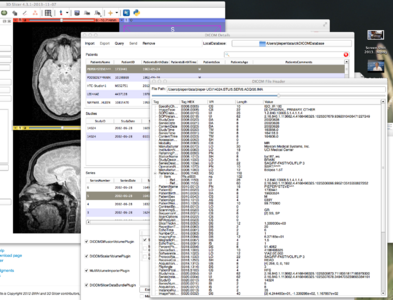 DICOM Header Browser