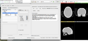 Slicer running as DICOM Hosted Application using CTK infrastructure