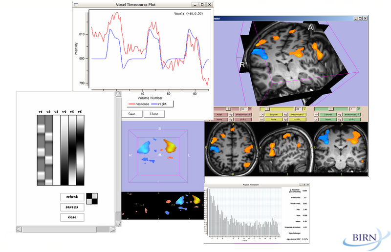 File:Slicer2-fmri-montage.png