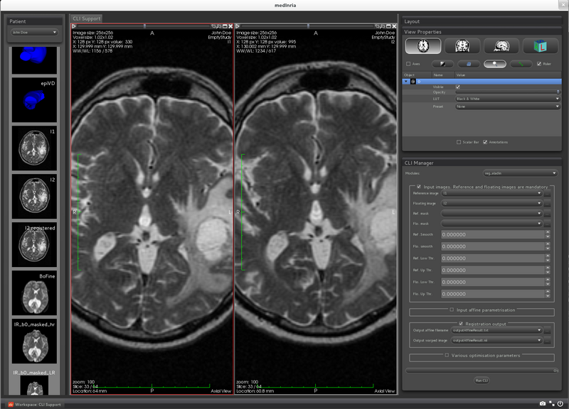 File:Medinria-cli-niftyreg.png