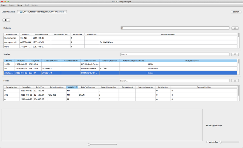 File:TableView Vertical Sorting.png