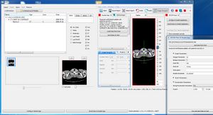 MITK running as DICOM Application Hosting hosted application (hosted by ctkDICOMHost) as well as hosting system with CTK-CLI as hosted application