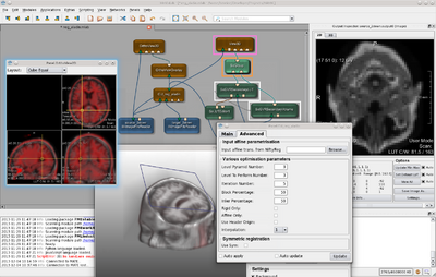 MeVisLab (see screencast)