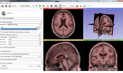 Niftyreg-slicer.png